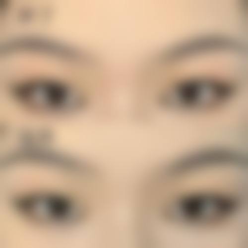 西安多美美诺医疗美容诊所怎么样特色项目及技术优势