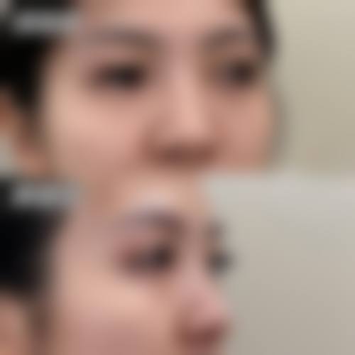 杨英医生的个性化价格方案