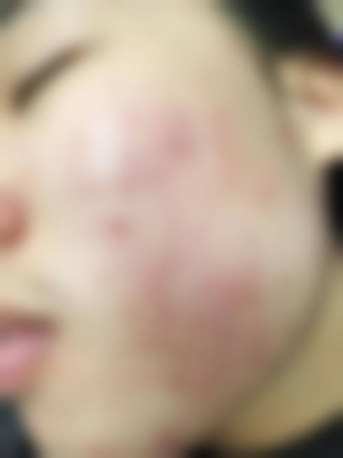 巫云医生的专精成效