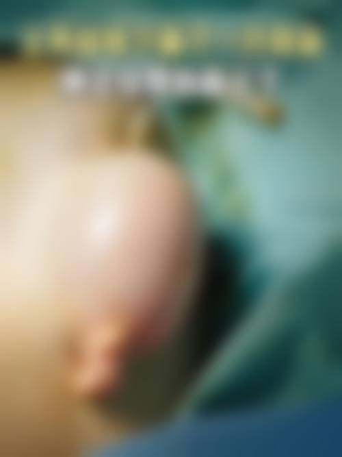 李炜毅医生的技术特色