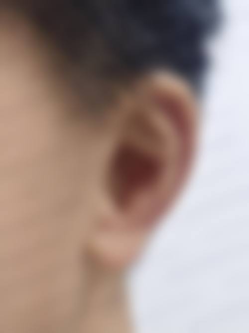 李向东可能擅长的医美项目