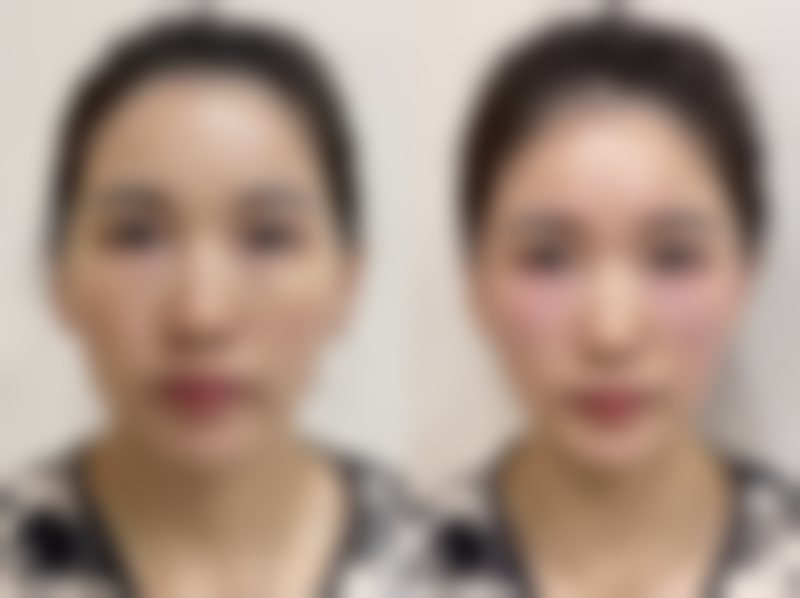 宁波唯美医疗美容诊所怎么样求美者反馈