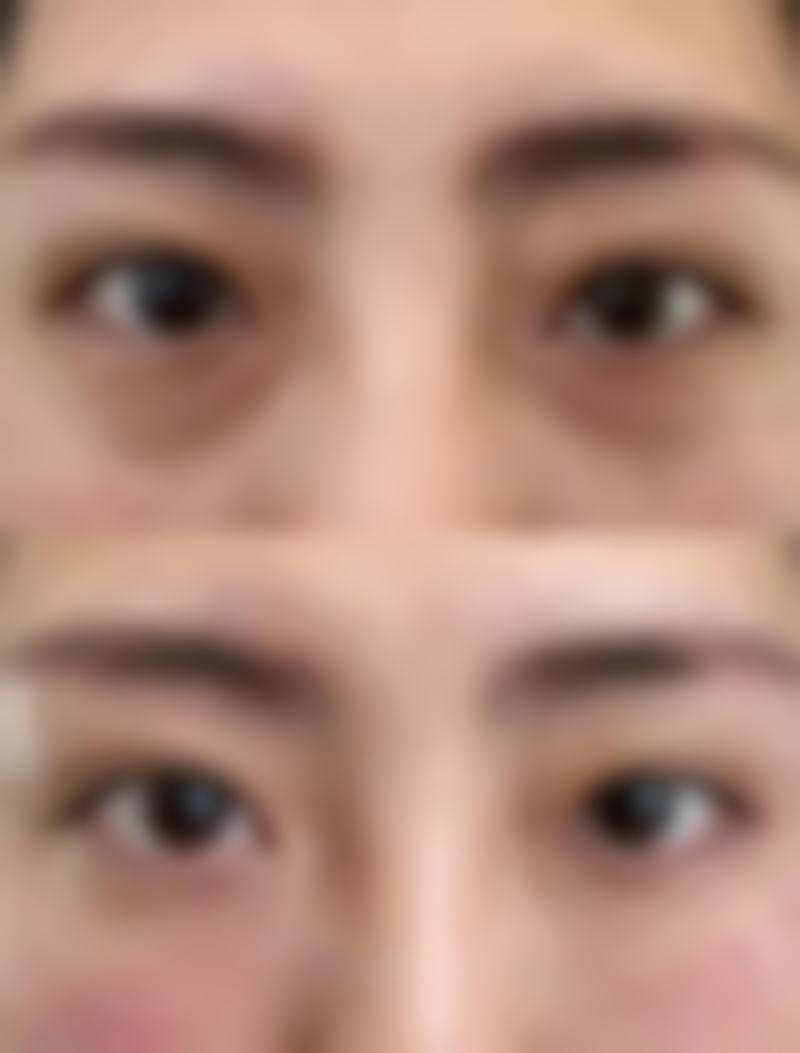 福州优医联合医美医疗美容诊所怎么样来院路线