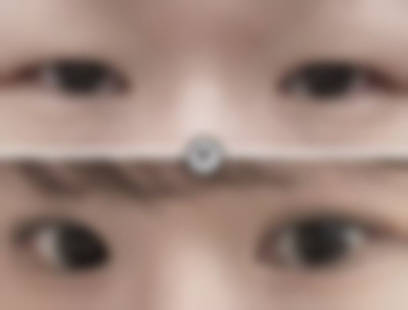 杨英医生的独特技术优势