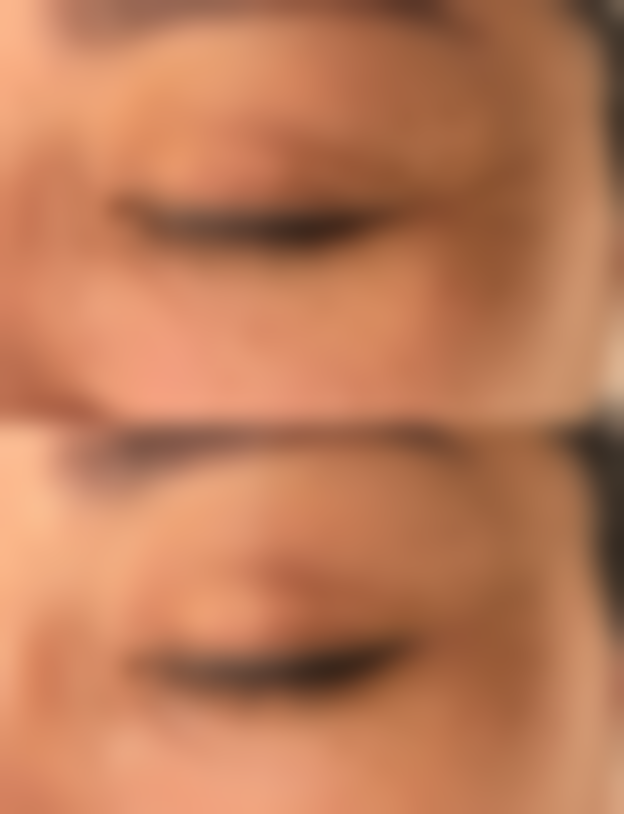 朝阳辽西医学美容整形门诊怎么样价格收费