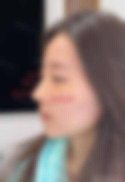 浙江省台州医院(整形美容科)怎么样求美者反馈