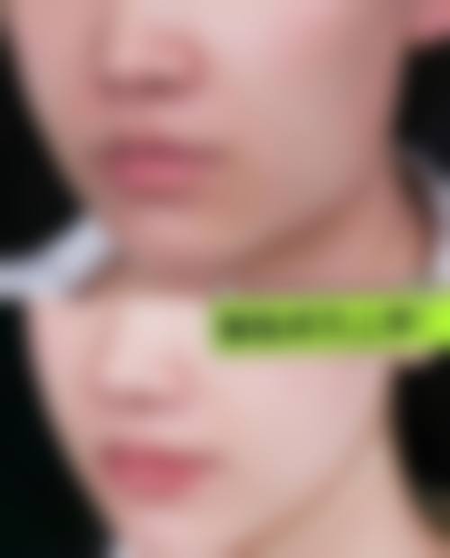 石承瓒医生的价格与服务优势