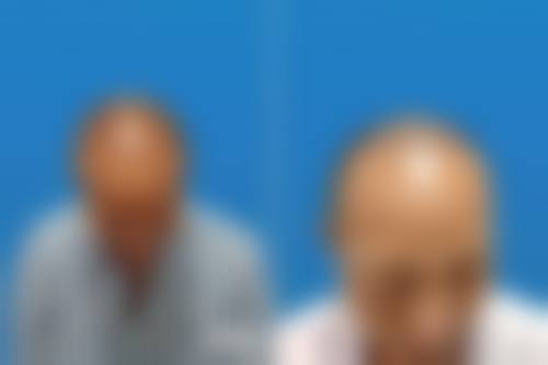 行动起来，重获浓密秀发