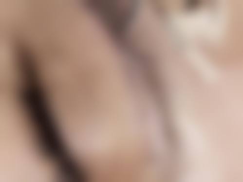 临沂艺生医疗美容门诊部怎么样求美者反馈