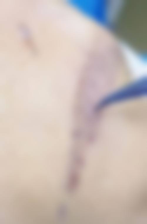 厦门雍禾植发医疗整形医院怎么样求美者反馈