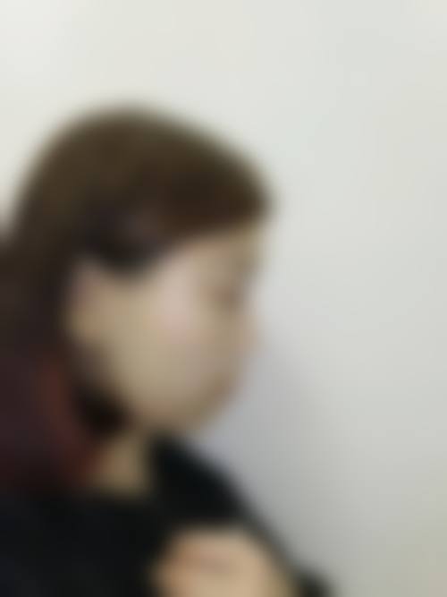 抚州心艺医疗美容门诊部怎么样价格收费