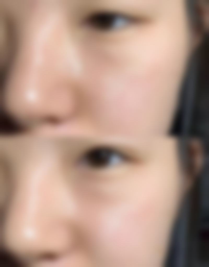 安徽安妮薇尔医疗美容怎么样求美者反馈