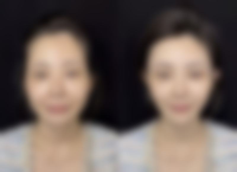 武汉米格医疗美容门诊部怎么样求美者反馈