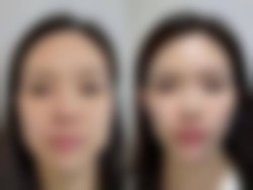 青岛水上伊人医疗美容诊所怎么样价格收费