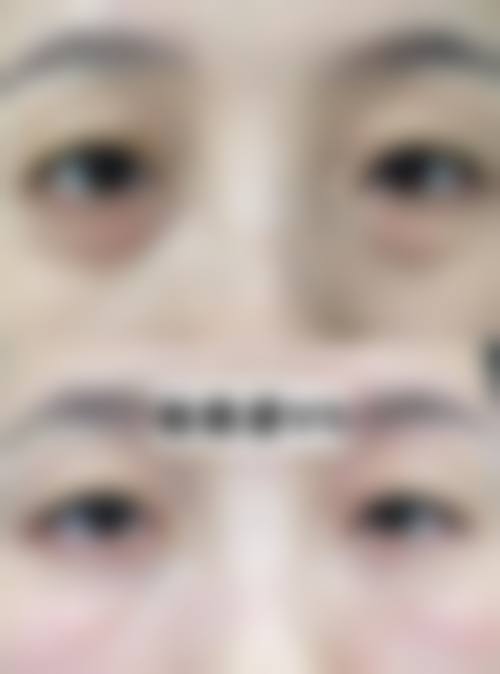 立即行动，体验龙卓宏医生的医美服务