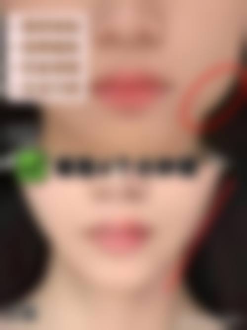 河北保定白沟姮美整形医疗美容中 心怎么样求美者反馈