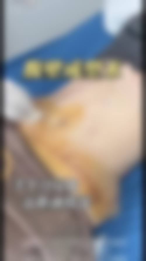 wooa整形医院怎么样价格收费