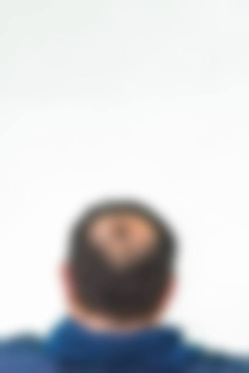 选择蔡允剑医生的理由