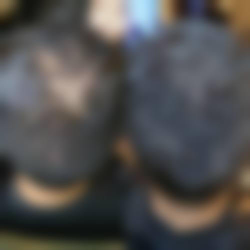 蔡允剑医生擅长的植发技术