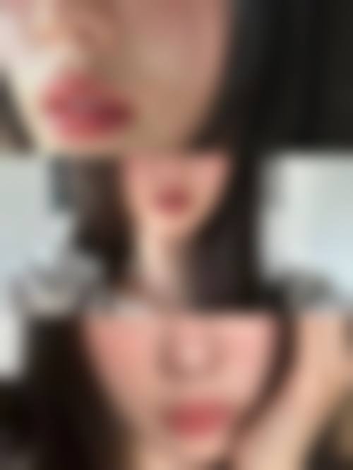 哈尔滨悠然整形医疗美容门诊部怎么样价格收费