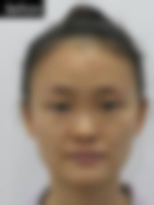 呼和浩特维科美容整形诊所怎么样医生团队实力