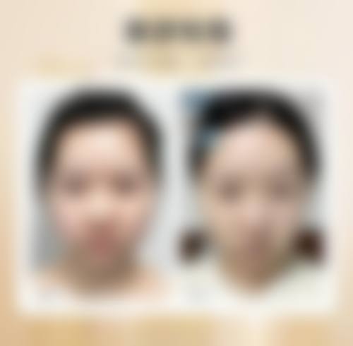 李德延医生注重沟通确保成效