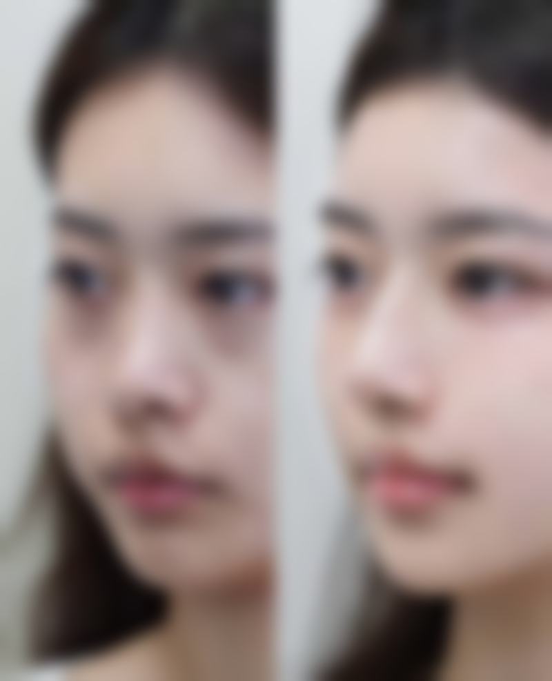 青岛水上伊人医疗美容诊所怎么样求美者反馈