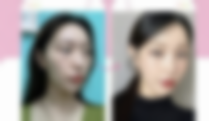 哈尔滨悠然整形医疗美容门诊部怎么样医生团队实力