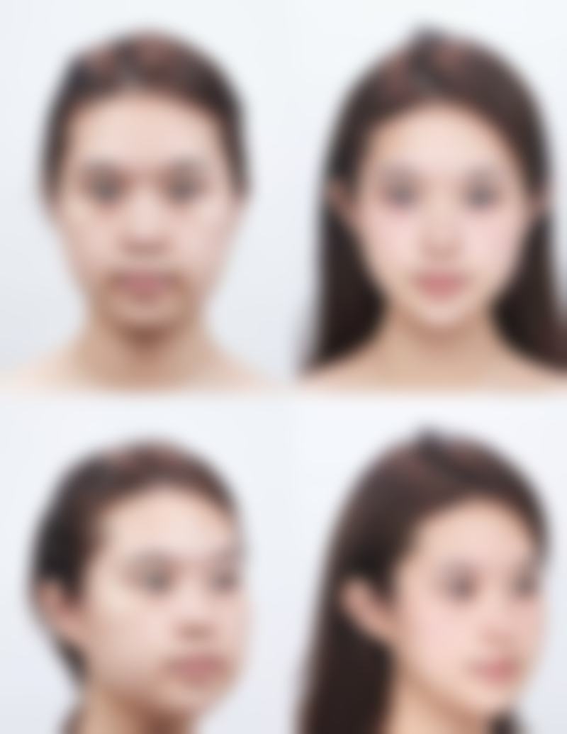 广州医选医疗美容怎么样特色项目及技术优势