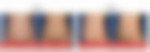 潮州韩美整形医院怎么样特色项目及技术优势