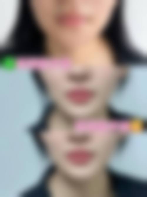 西安华尔倍丽医疗美容诊所怎么样医生团队实力