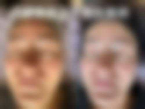 长沙贝碧斐丝医学美学机构怎么样价格收费