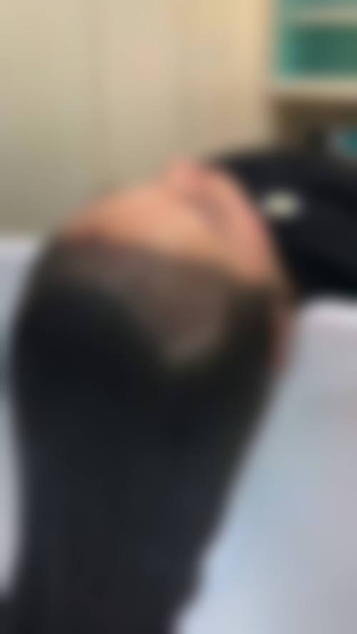 信赖蔡允剑医生,开启植发之旅