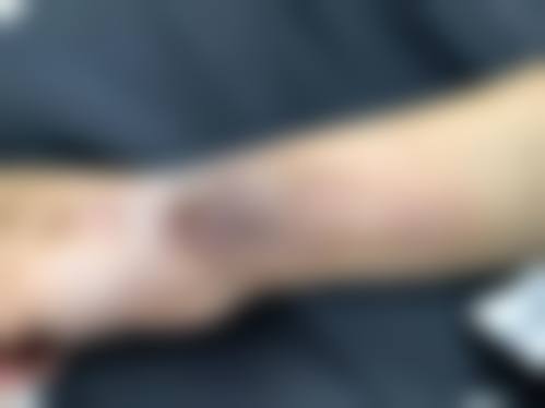 深圳市福田人民医院整形外科怎么样价格收费