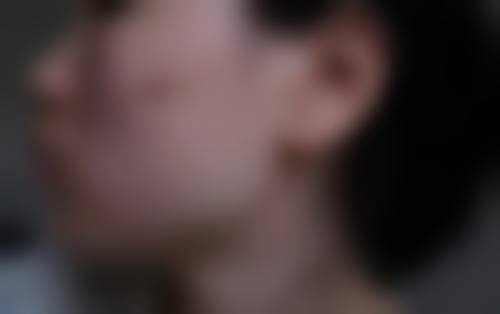 深圳市福田人民医院整形外科怎么样医生团队实力