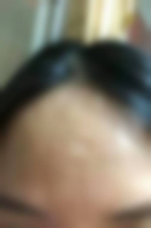 深圳市福田人民医院整形外科怎么样简介概述