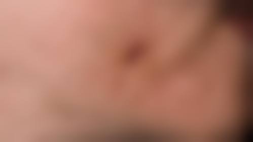 深圳市福田人民医院整形外科怎么样特色项目及技术优势