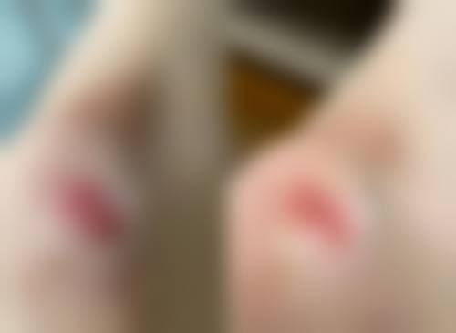 深圳市福田人民医院整形外科怎么样求美者反馈