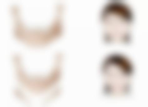 深圳刘运奇医疗美容诊所怎么样来院路线