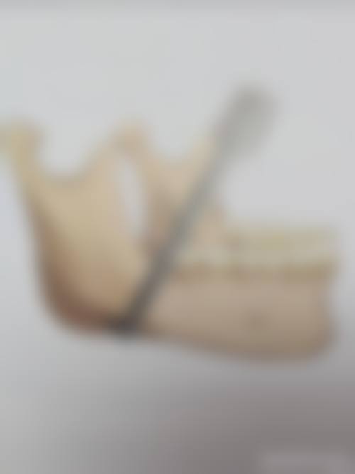 台湾童話時尚整形怎么样特色项目及技术优势