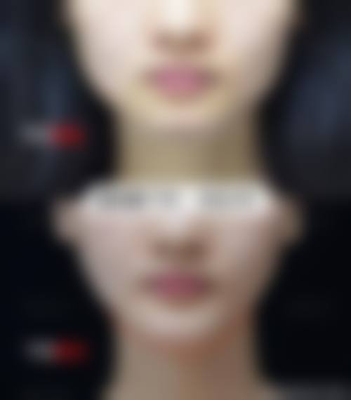 李德延医生擅长的整形项目