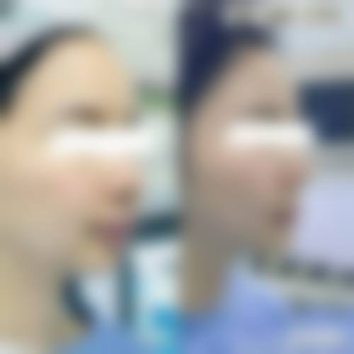 李德延医生手术的高满意度