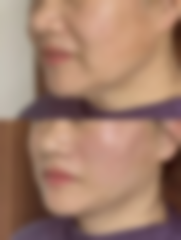 潮州韩美整形医院怎么样简介概述