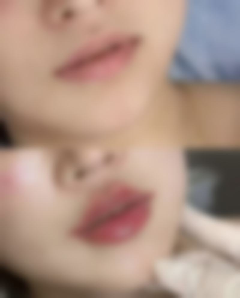 西安华尔倍丽医疗美容诊所怎么样特色项目及技术优势