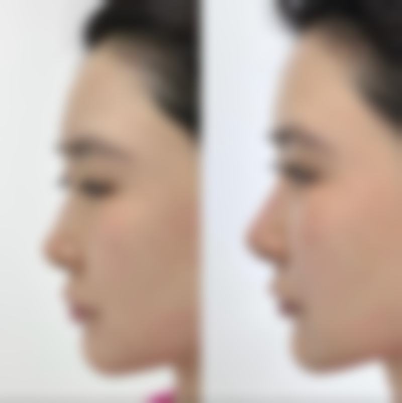 潮州韩美整形医院怎么样基本信息