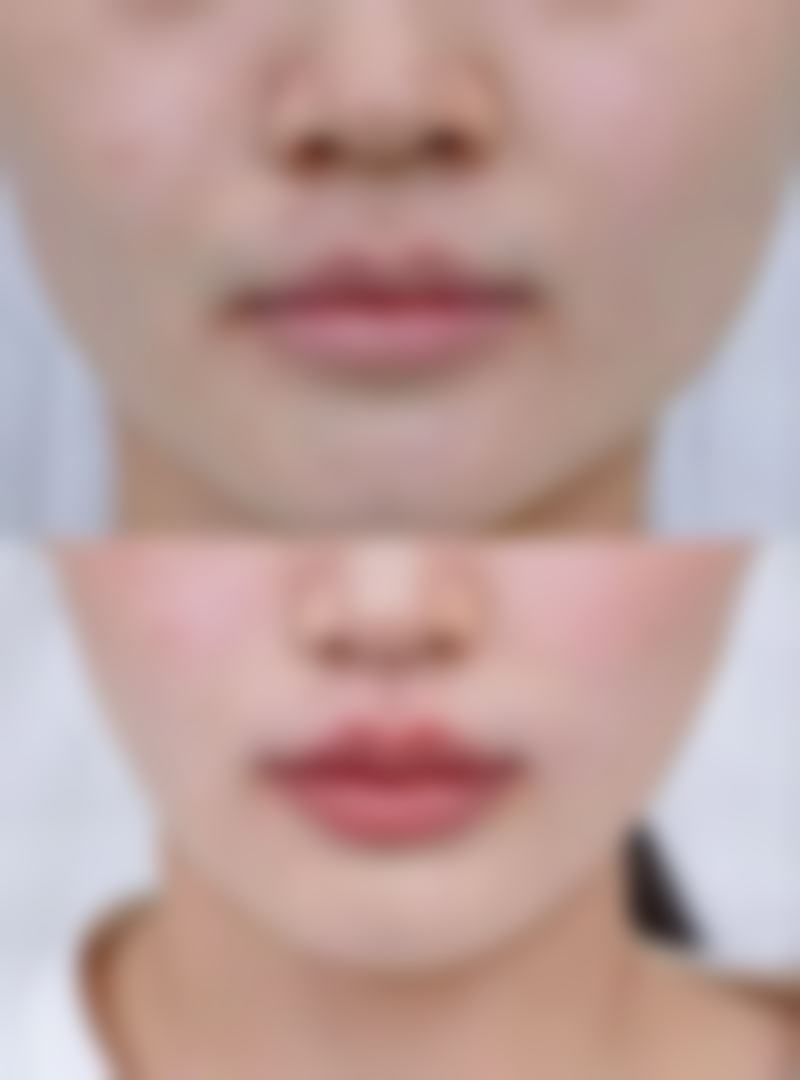 西安华尔倍丽医疗美容诊所怎么样求美者反馈