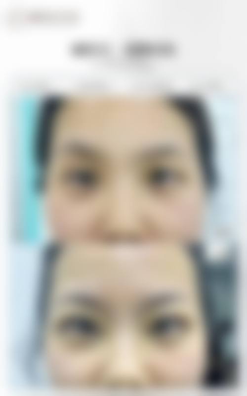 郑州艺龄医疗美容门诊部怎么样求美者反馈