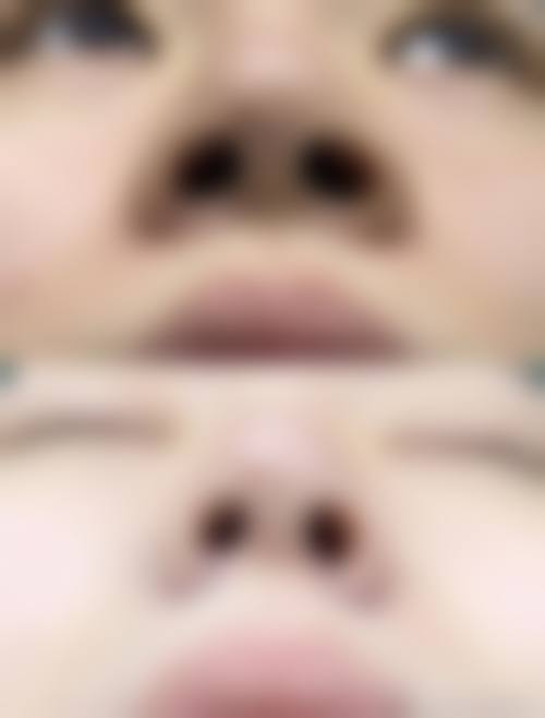 石承瓒医生助力的成功实例