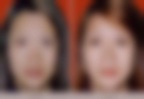 李德延医生的特色技术优势