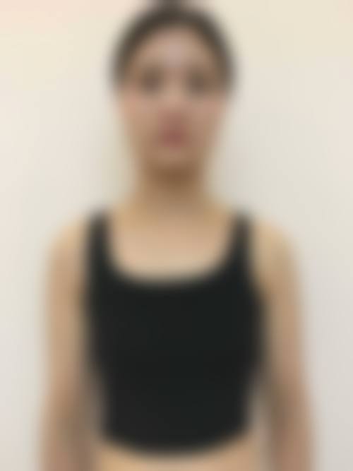 西安天娇德美医疗美容诊所怎么样特色项目及技术优势